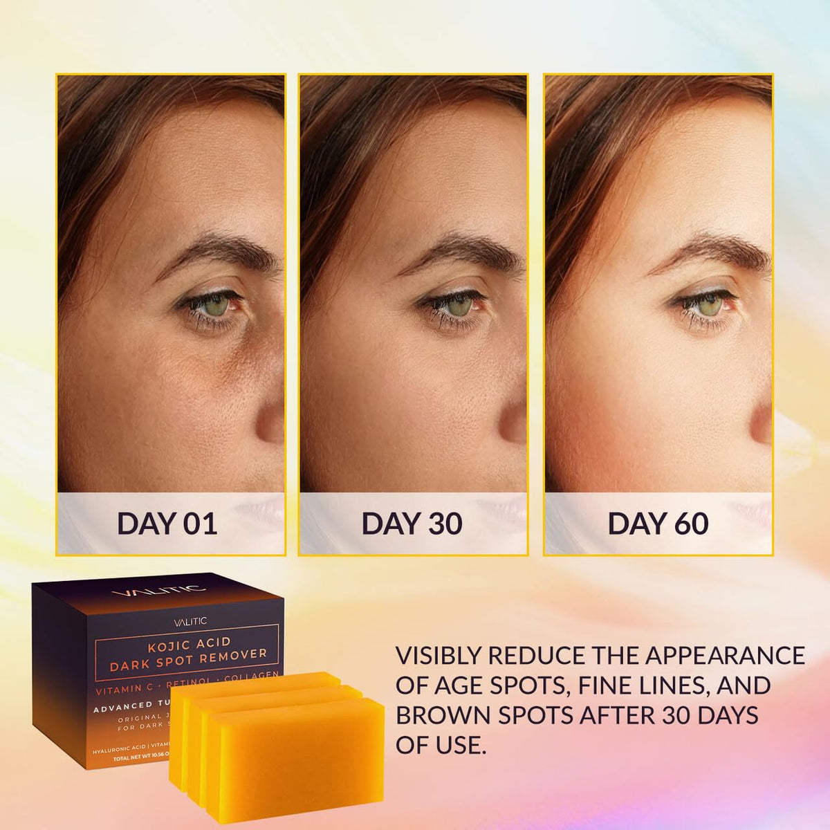 Kojic Acid Dark Spot Remover Soap Bars with Vitamin C, Retinol, Collagen, Turmeric - Original Japanese Complex Infused with Hyaluronic Acid, Vitamin E, Shea Butter, Castile Olive Oil (3 Pack)
