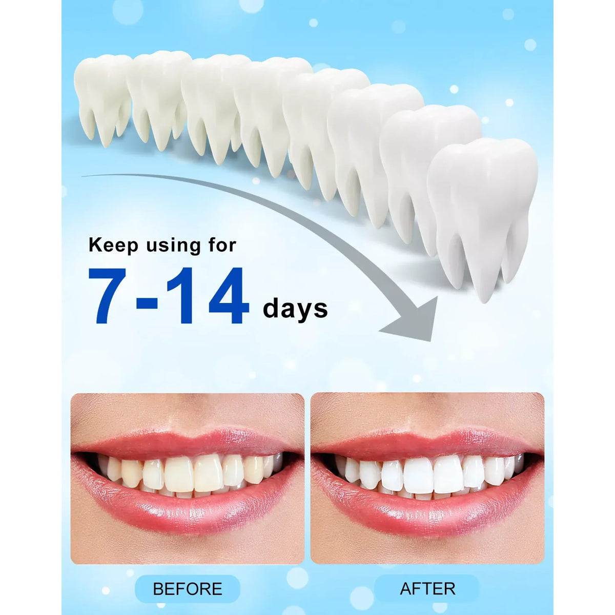Deluxe Teeth Whitening Kit with 28-LED Light, 4X Teeth Whitening Pen Whitening Gel Refills, 10Mins Results, Remove 10 Years of Stains