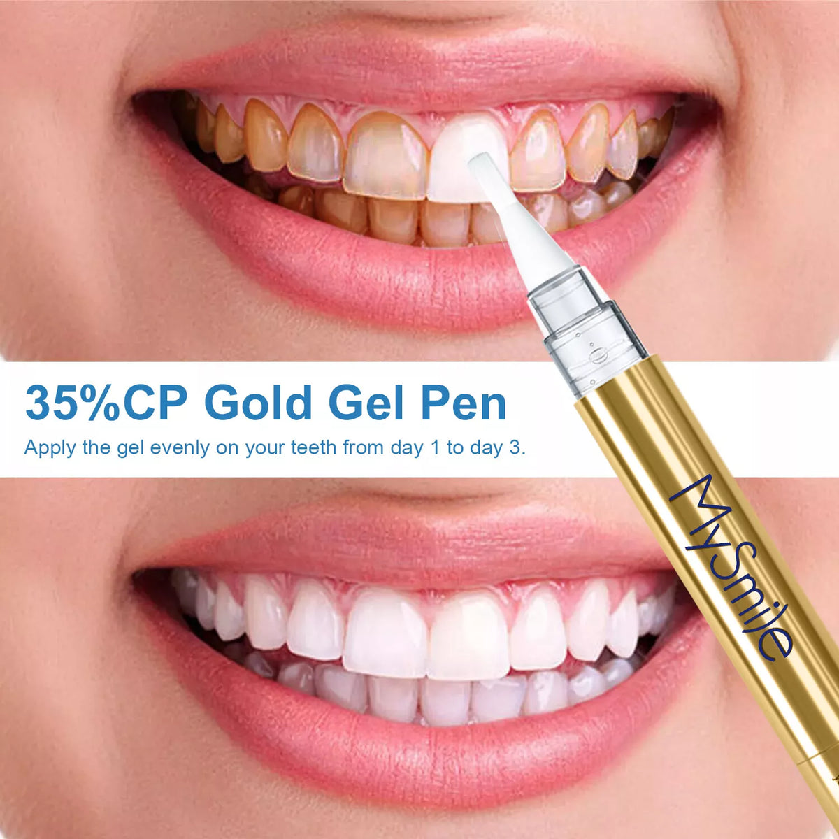 Deluxe Teeth Whitening Kit with 28-LED Light, 4X Teeth Whitening Pen Whitening Gel Refills, 10Mins Results, Remove 10 Years of Stains