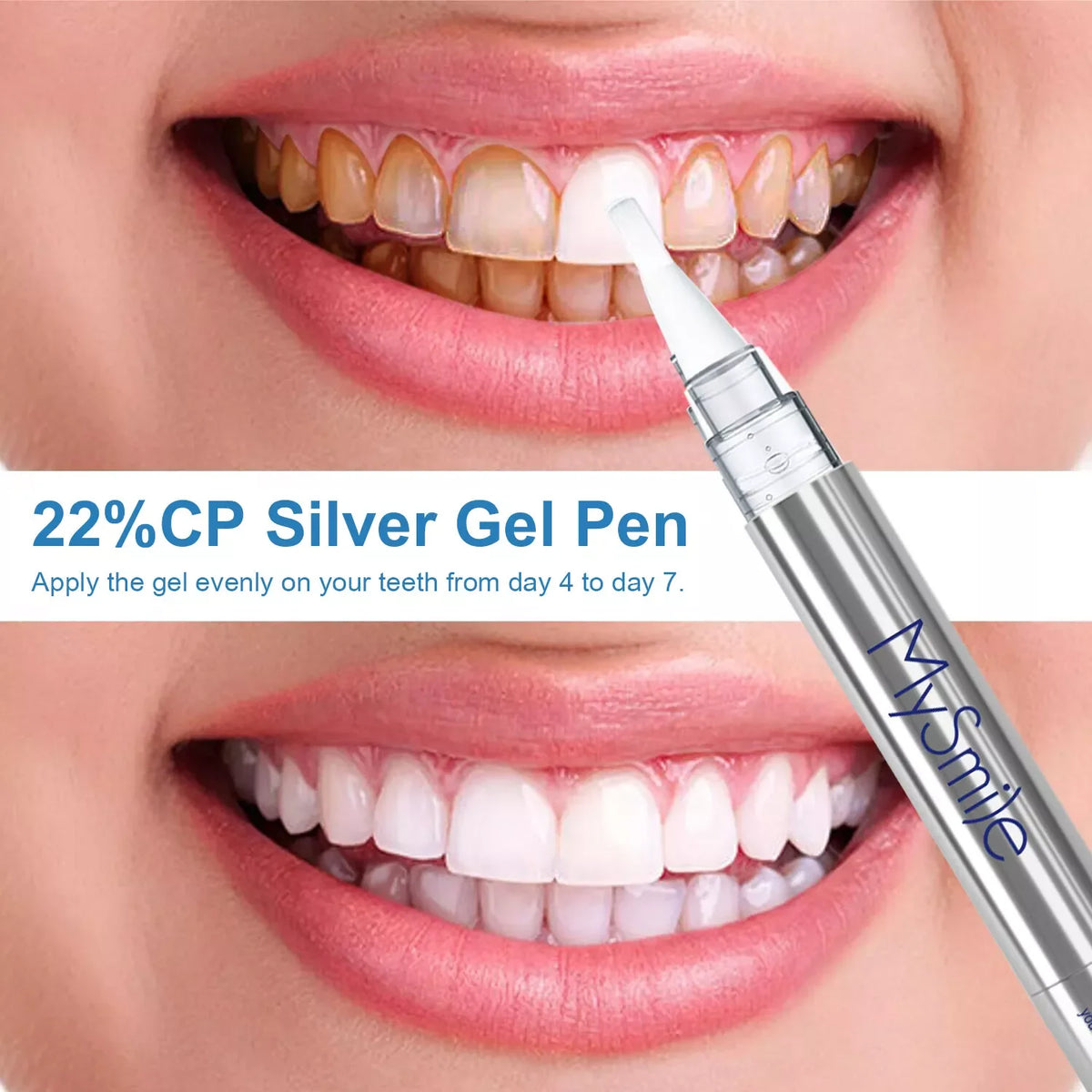 Deluxe Teeth Whitening Kit with 28-LED Light, 4X Teeth Whitening Pen Whitening Gel Refills, 10Mins Results, Remove 10 Years of Stains
